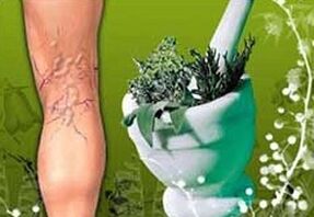 biljke za liječenje proširenih vena