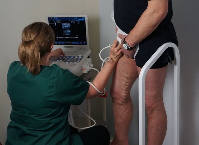 pregled vena prije laserske koagulacije za varikozne vene
